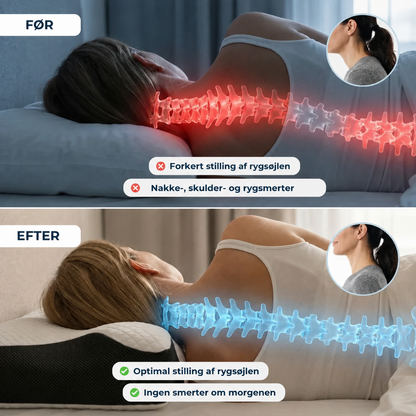 NakkeRo™ | Ergonomisk nakkepude